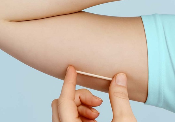 Ministério Público Aciona Justiça para Interdição de Farmácia e Proibição de Venda de Implantes Hormonais Imagem do artigo