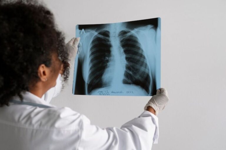 Brasil não atinge meta da OMS para tuberculose; casos aumentam alarmantemente