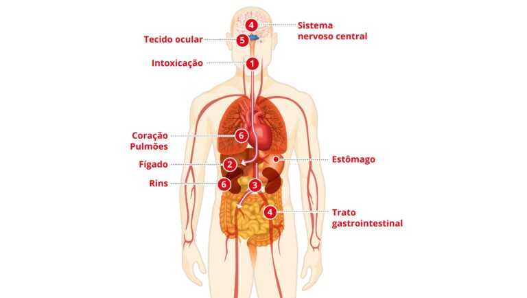 Intoxicação por Metanol na Bahia: Entenda os Riscos e o Tratamento Eficaz