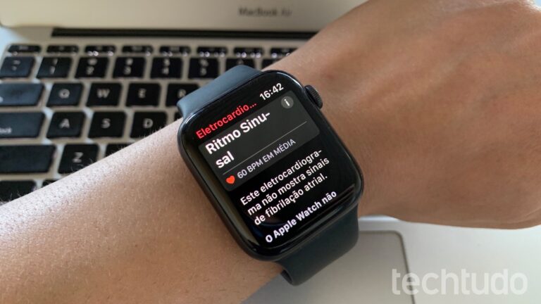 Smartwatches com ECG: 6 Melhores Modelos para Monitorar a Saúde do Coração