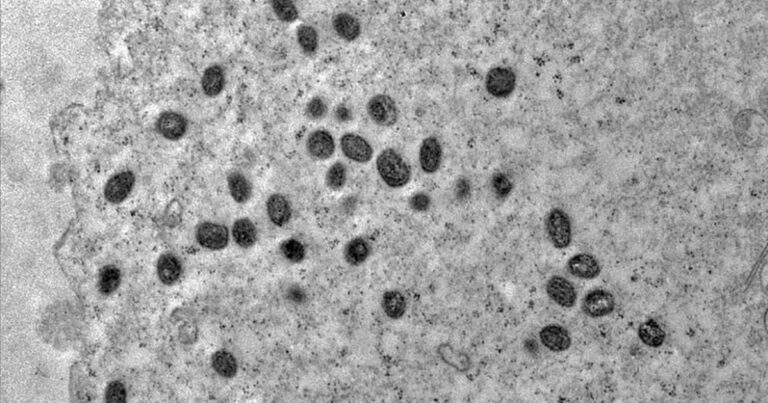 Mpox no Brasil: Ministério da Saúde minimiza alerta apesar de 140 casos confirmados