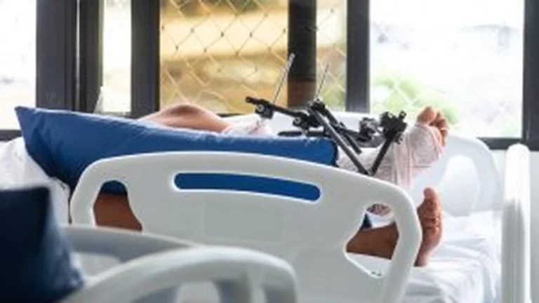 Custos de acidentes de motocicleta na Bahia
